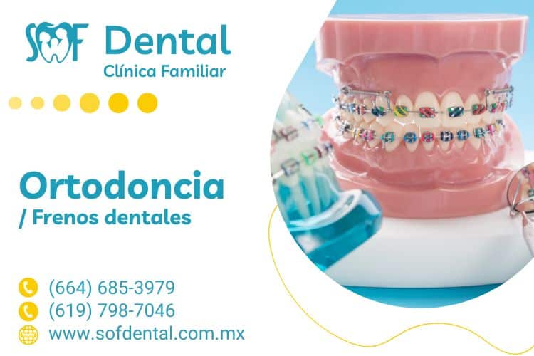 Ortodoncia en Tijuana Clínica SOFDental