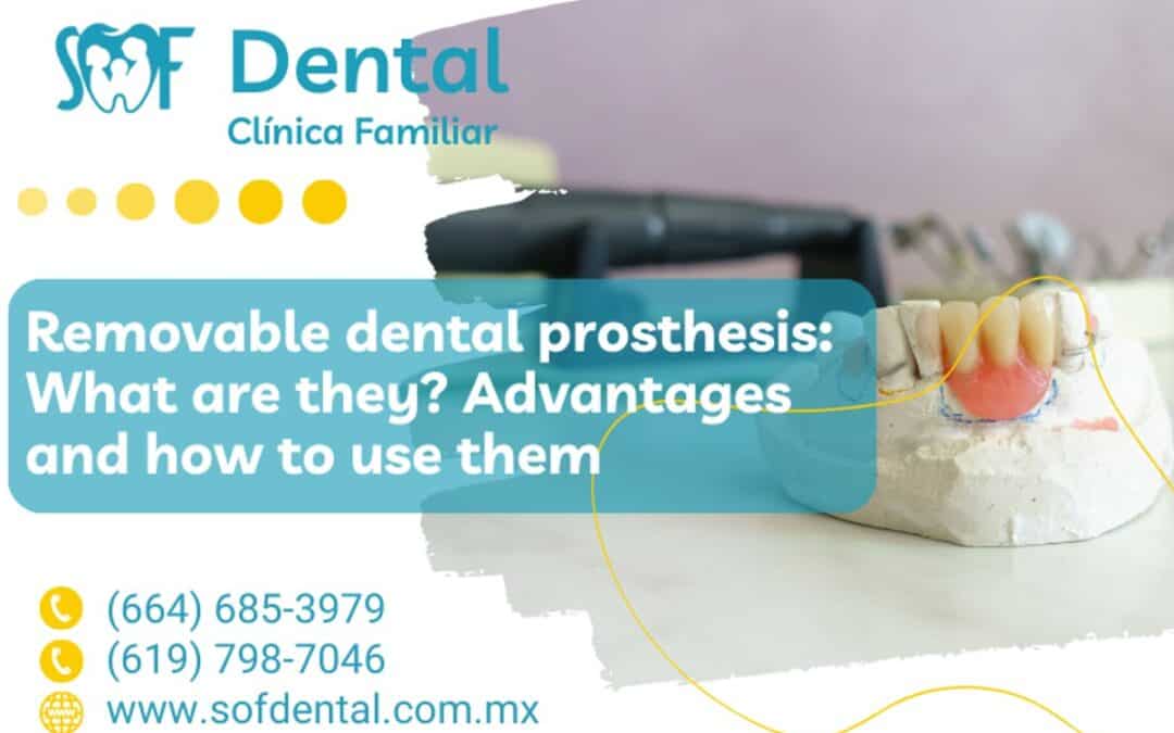 Removable dental prosthesis: What are they? Advantages and how to use them